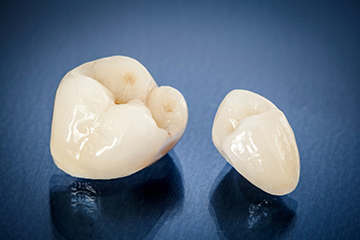 Close-up of two dental crowns in Tustin, CA