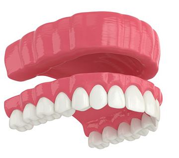 Illustration of full denture for upper arch